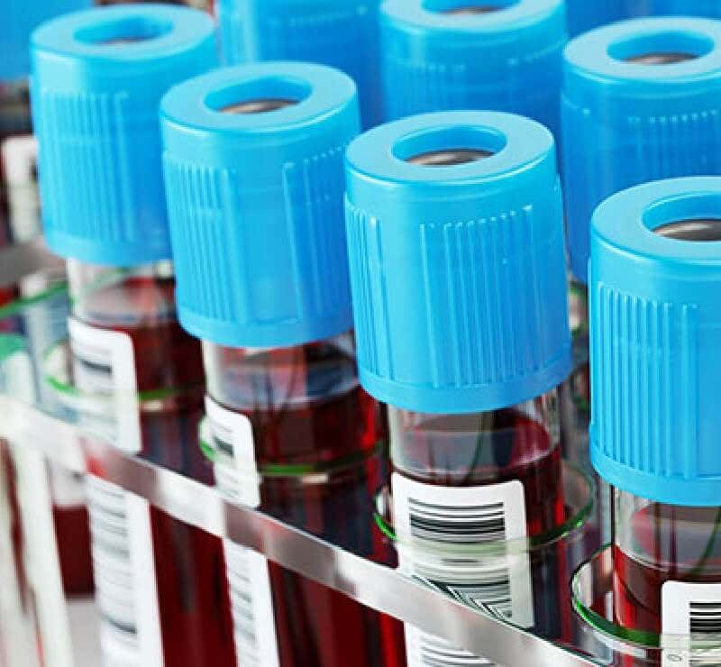 Haemoglobin Analysis