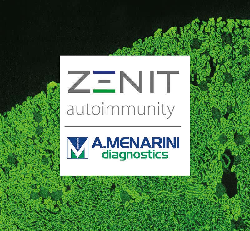 Autoimmunity