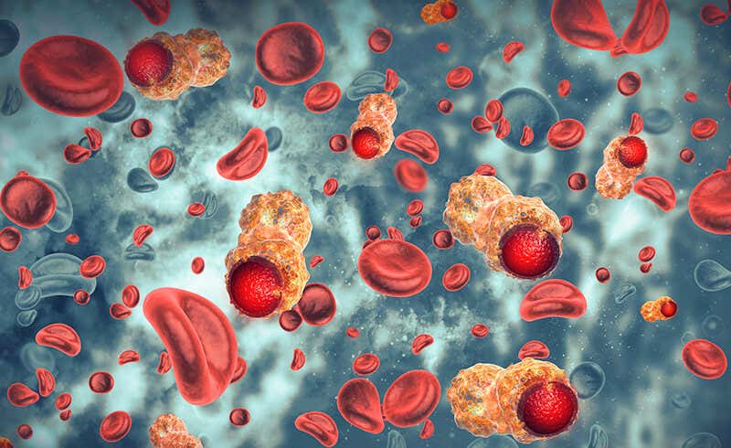 oncology