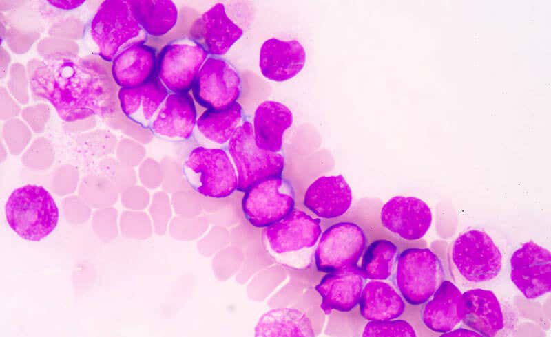 oncology