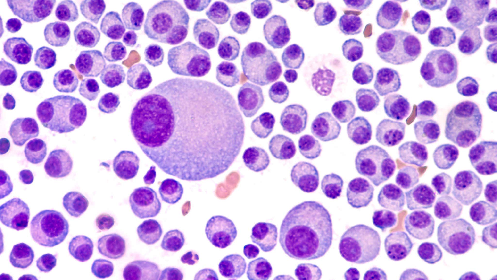 oncology