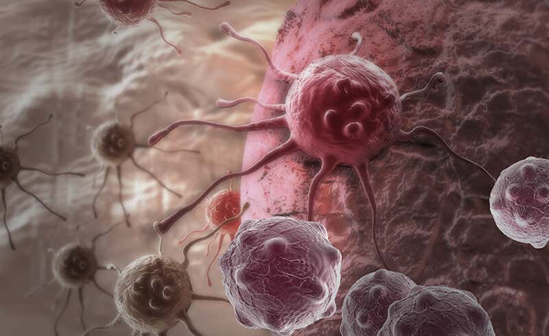 oncology